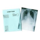 MS029 - Chest X-ray