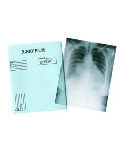 MS029 - Chest X-ray