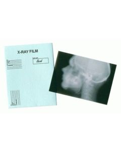 MS030 - Skull X-ray